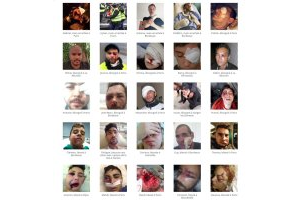 Mur des bléssé-e-s